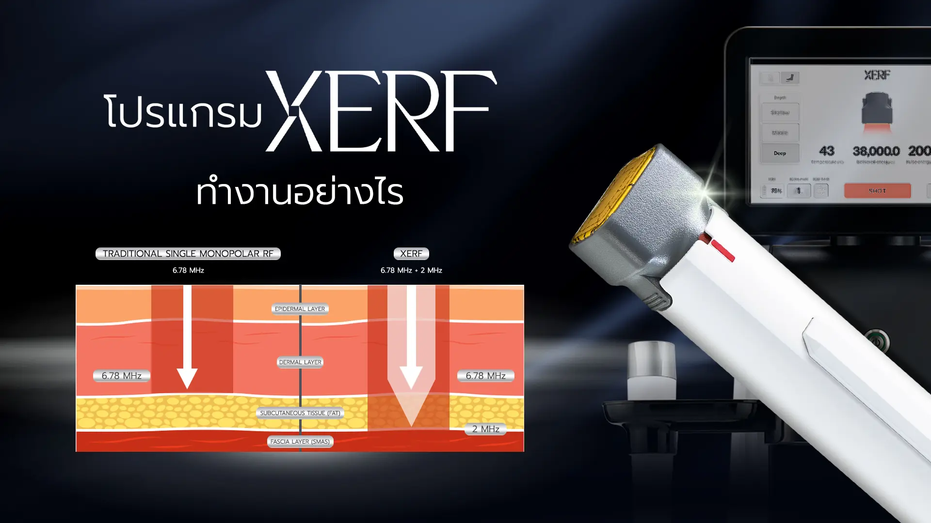เทคโนโลยี XERF ทำงานอย่างไร (หลักการ Multi-Frequency RF)